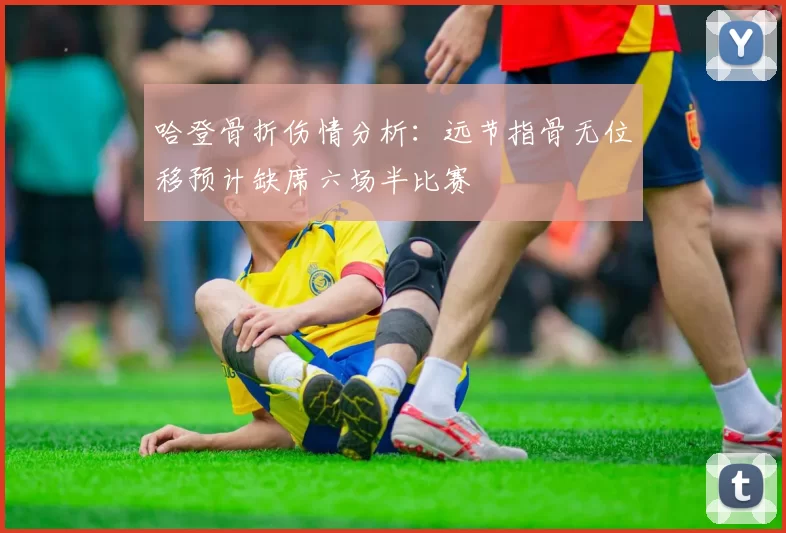 哈登骨折伤情分析：远节指骨无位移预计缺席六场半比赛
